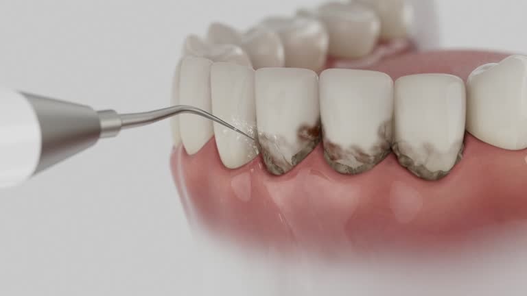 Trusted Wisdom Tooth Removal service in Edgard, LA - Dentist Open Now